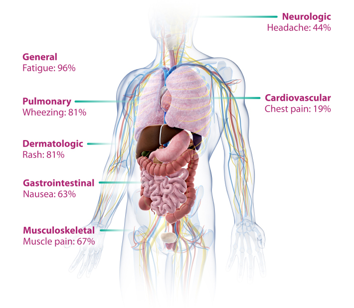 Medical infographic describing eosinophilic inflammation and disease progression in Hypereosinophilic Syndrome (HES) 