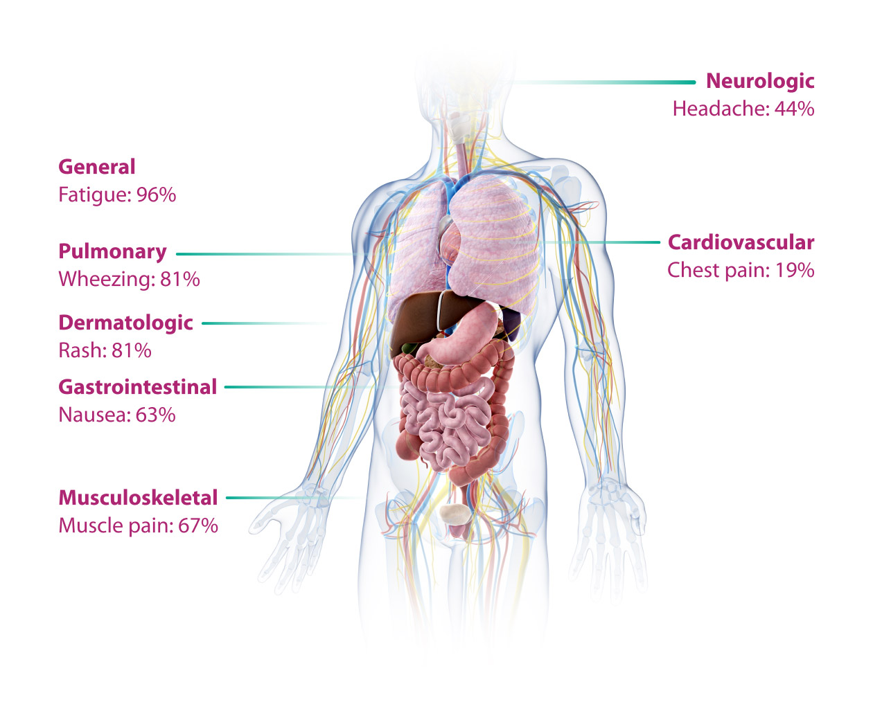 Medical infographic describing eosinophilic inflammation and disease progression in Hypereosinophilic Syndrome (HES) 